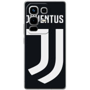 Чохол BoxFace Infinix Note 50 Pro Plus FC J