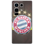 Чохол BoxFace Infinix Note 50 Pro Plus 