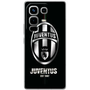 Чохол BoxFace Infinix Note 50 Pro Plus 