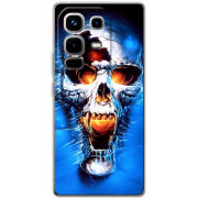 Чохол BoxFace Infinix Note 50 Pro Plus 