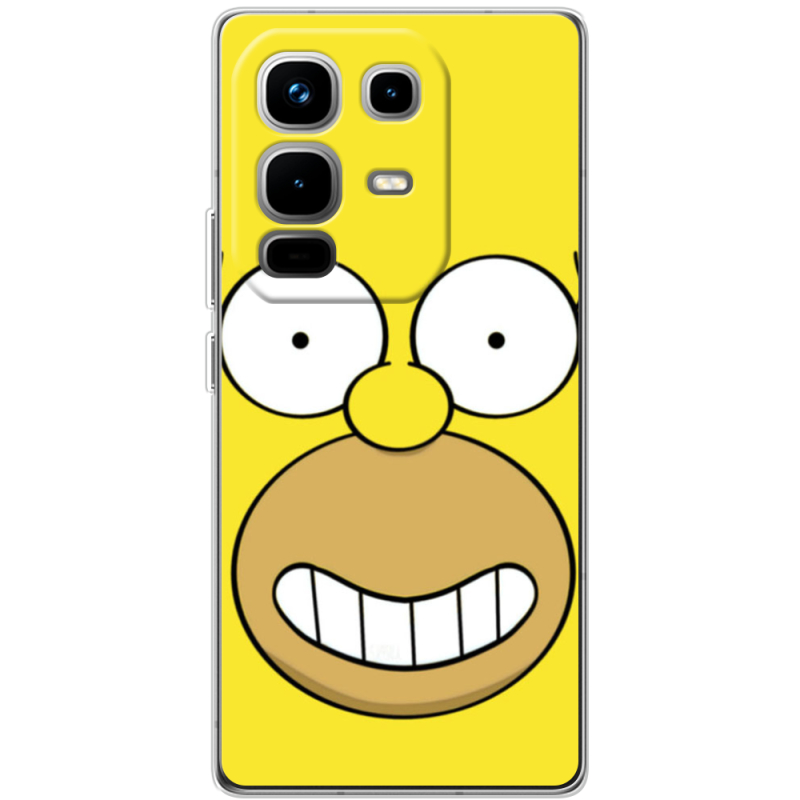 Чохол BoxFace Infinix Note 50 Pro Plus 