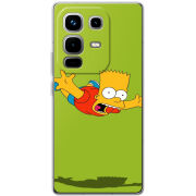 Чохол BoxFace Infinix Note 50 Pro Plus 
