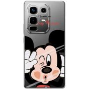 Прозорий чохол BoxFace Infinix Note 50 Pro Plus Mister M