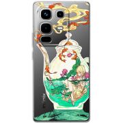 Прозорий чохол BoxFace Infinix Note 50 Pro Plus Kettle