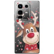 Прозорий чохол BoxFace Infinix Note 50 Pro Plus Winter Deer