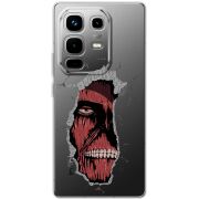 Прозорий чохол BoxFace Infinix Note 50 Pro Plus Нападение Титана