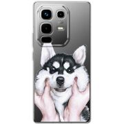 Прозорий чохол BoxFace Infinix Note 50 Pro Plus Husky