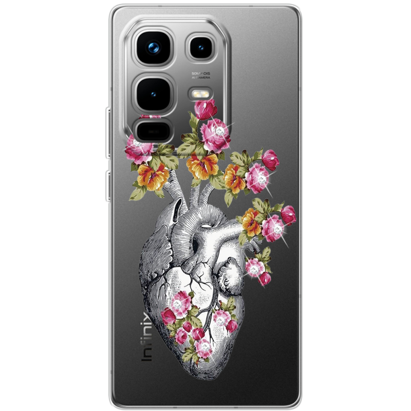 Чохол зі стразами Infinix Note 50 Pro Plus Heart