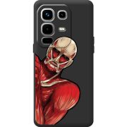 Чорний чохол BoxFace Infinix Note 50 Pro Plus Титан