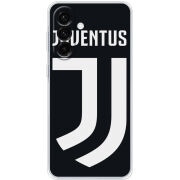 Чохол BoxFace Samsung Galaxy A17 (A175) FC J