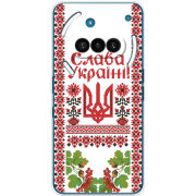 Чохол BoxFace Nothing Phone (3a) 