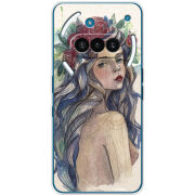 Чохол BoxFace Nothing Phone (3a) 