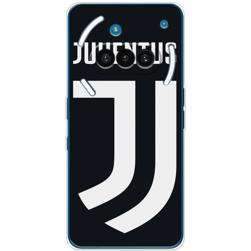 Чохол BoxFace Nothing Phone (3a) FC J