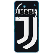 Чохол BoxFace Nothing Phone (3a) FC J