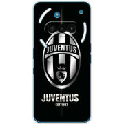 Чохол BoxFace Nothing Phone (3a) 