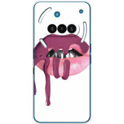 Чохол BoxFace Nothing Phone (3a) 