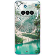 Чохол BoxFace Nothing Phone (3a) 