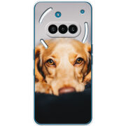 Чохол BoxFace Nothing Phone (3a) 