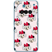 Чохол BoxFace Nothing Phone (3a) 