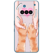 Чохол BoxFace Nothing Phone (3a) 