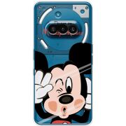 Прозорий чохол BoxFace Nothing Phone (3a) Mister M