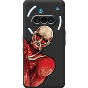 Чорний чохол BoxFace Nothing Phone (3a) Титан