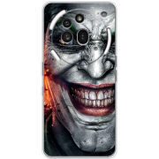 Чохол BoxFace Nothing Phone (3a) Pro Prankster