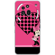 Чохол BoxFace Nothing Phone (3a) Pro 