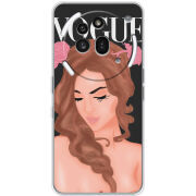 Чохол BoxFace Nothing Phone (3a) Pro Fashion Girl