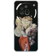 Чохол BoxFace Nothing Phone (3a) Pro Exquisite White Flowers