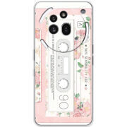 Чохол BoxFace Nothing Phone (3a) Pro 