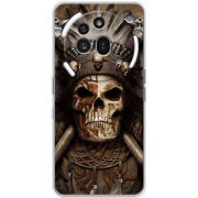 Чохол BoxFace Nothing Phone (3a) Pro 