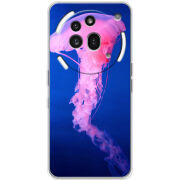 Чохол BoxFace Nothing Phone (3a) Pro 