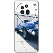 Чохол BoxFace Nothing Phone (3a) Pro 