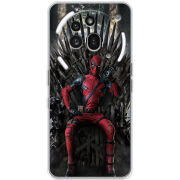 Чохол BoxFace Nothing Phone (3a) Pro 