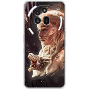 Чохол BoxFace Nothing Phone (3a) Pro 
