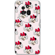 Чохол BoxFace Nothing Phone (3a) Pro 