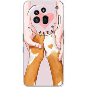 Чохол BoxFace Nothing Phone (3a) Pro 