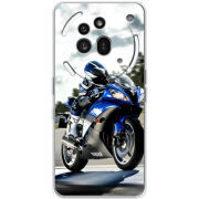 Чохол BoxFace Nothing Phone (3a) Pro 