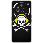 Чохол BoxFace Nothing Phone (3a) Pro 