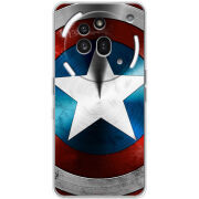 Чохол BoxFace Nothing Phone (3a) Pro 