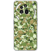 Чохол BoxFace Nothing Phone (3a) Pro 