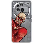 Прозорий чохол BoxFace Nothing Phone (3a) Pro Титан