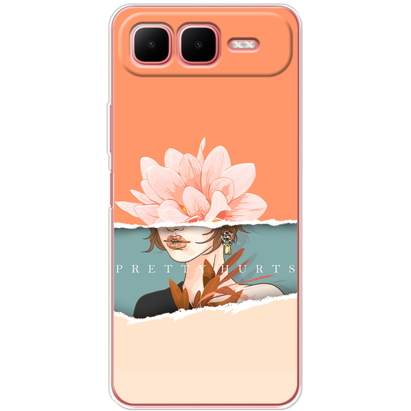 Чохол BoxFace Infinix Smart 10 Plus 