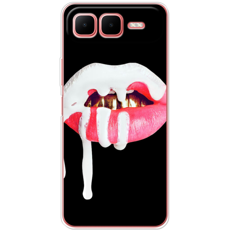 Чохол BoxFace Infinix Smart 10 Plus 