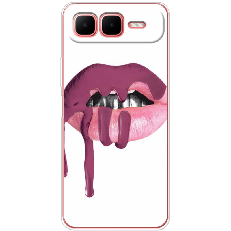 Чохол BoxFace Infinix Smart 10 Plus 