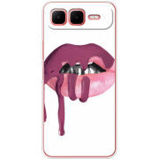 Чохол BoxFace Infinix Smart 10 Plus 
