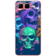 Чохол BoxFace Infinix Smart 10 Plus 