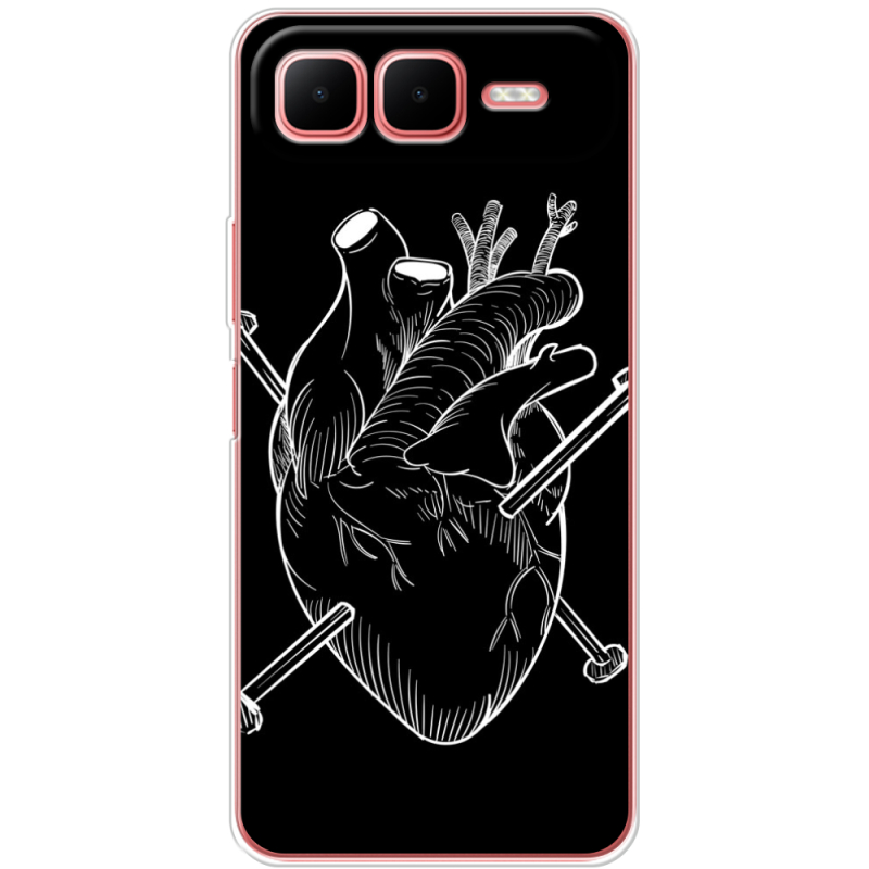 Чохол BoxFace Infinix Smart 10 Plus 