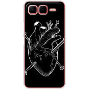 Чохол BoxFace Infinix Smart 10 Plus 